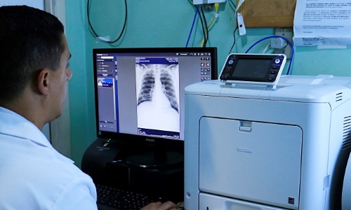 Hospital de Itatiaia utiliza equipamento de ponta para impressão de exames de Raio X